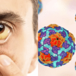 Jaundice outbreak in Mayurbhanj
